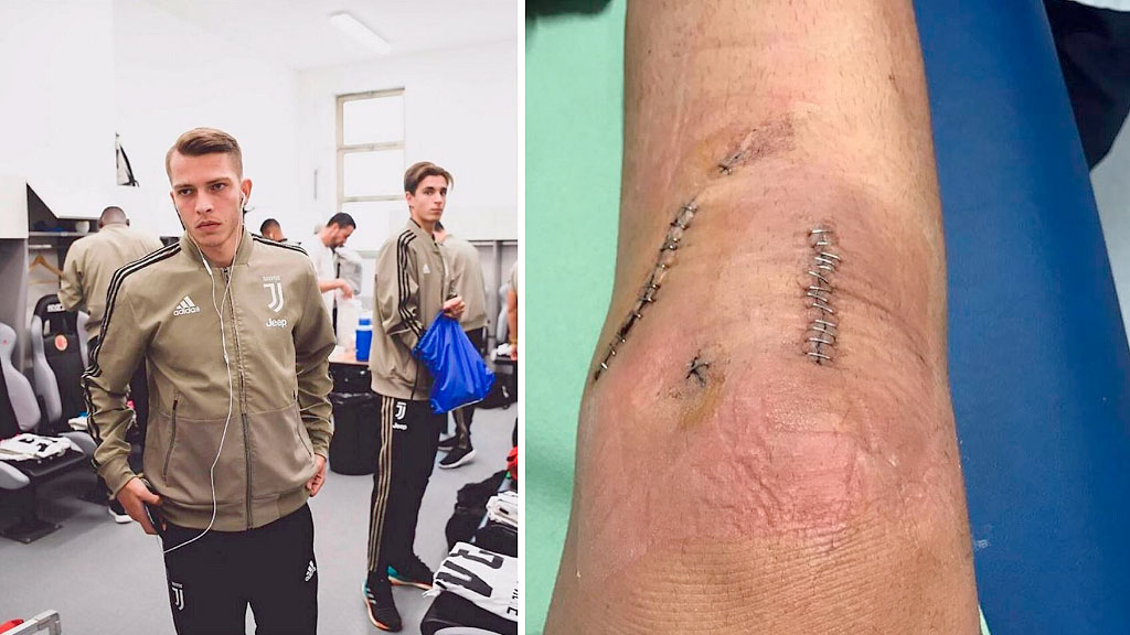 Cendrim Kameraj, Juventus, Cristiano Ronaldo, futbolista suizo, ex jugador de Juventus, Cristiano Ronaldo, lesiones en el fútbol, vida después del deporte, promesa del fútbol, fútbol y resiliencia, retirado del fútbol, jugador suizo Kosovo