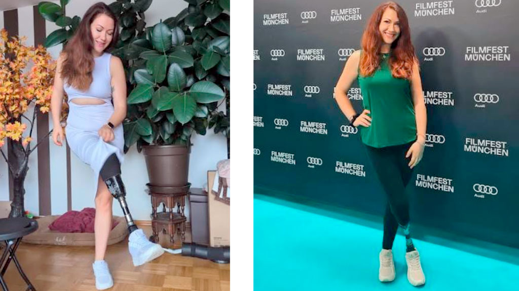 Minka Omeragic, Miss Alemania, Prótesis, prótesis de pierna, discapacidad, certamen de belleza, Wernigerode, inclusión, superación personal