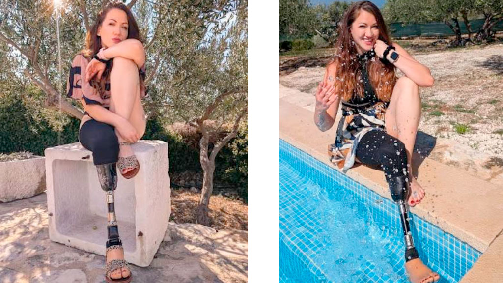 Minka Omeragic, Miss Alemania, Prótesis, prótesis de pierna, discapacidad, certamen de belleza, Wernigerode, inclusión, superación personal