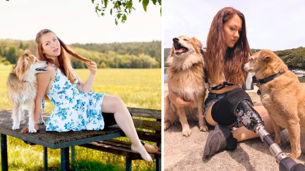 Minka Omeragic, Miss Alemania, Prótesis, prótesis de pierna, discapacidad, certamen de belleza, Wernigerode, inclusión, superación personal