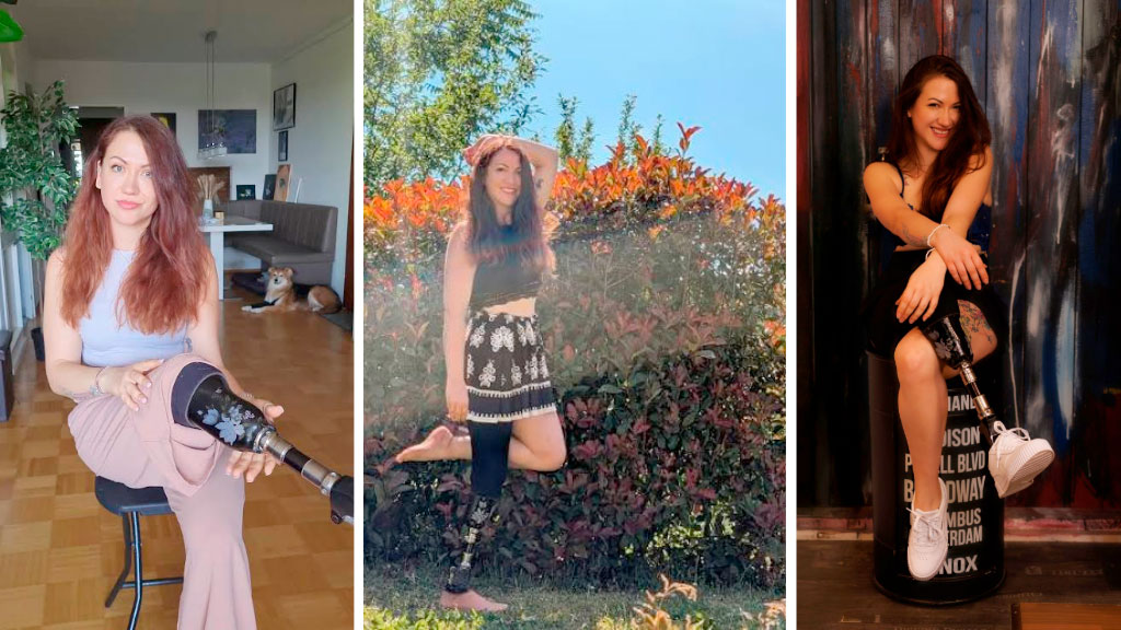 Minka Omeragic, Miss Alemania, Prótesis, prótesis de pierna, discapacidad, certamen de belleza, Wernigerode, inclusión, superación personal