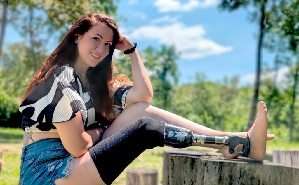 Minka Omeragic, Miss Alemania, Prótesis, prótesis de pierna, discapacidad, certamen de belleza, Wernigerode, inclusión, superación personal