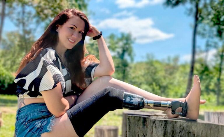 Minka Omeragic, Miss Alemania, Prótesis, prótesis de pierna, discapacidad, certamen de belleza, Wernigerode, inclusión, superación personal