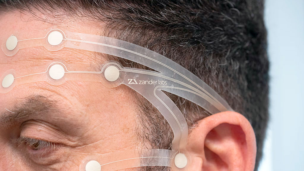 Alemania, burocracia, financiamiento, Zanderlab, Quantum Diamonds, Thorsten Zander, start-ups Alemania, innovación tecnológica alemana, capital riesgo Europa, inteligencia artificial Alemania, empresas emergentes alemanas, inversores extranjeros start-ups, Zanderlab interfaz cerebro, Quantum Diamonds microchips, financiamiento start-ups, burocracia innovación Alemania