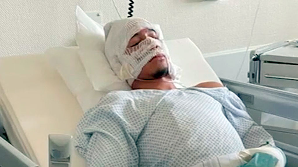 Tahirys Dos Santos, Crans-Montana, FC Metz, bar Constellation tragedia, futbolista sobreviviente incendio, Año Nuevo Suiza 2026, quemaduras 30% cuerpo, tragedia resort suizo, FC Metz defensor, Coline pareja Dos Santos, incendio bar Suiza víctimas