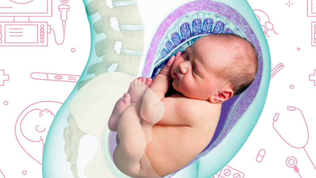 Parto en casa, Homicidio culposo, Neu-Ulm, parto en casa sin asistencia médica, parto en solitario riesgos, homicidio culposo recién nacido Alemania, posición podálica parto domiciliario, Alleingeburt fenómeno redes sociales, partos no asistidos Argentina, parto humanizado ley argentina, mortalidad infantil Alemania estadísticas, partera parto domiciliario riesgos